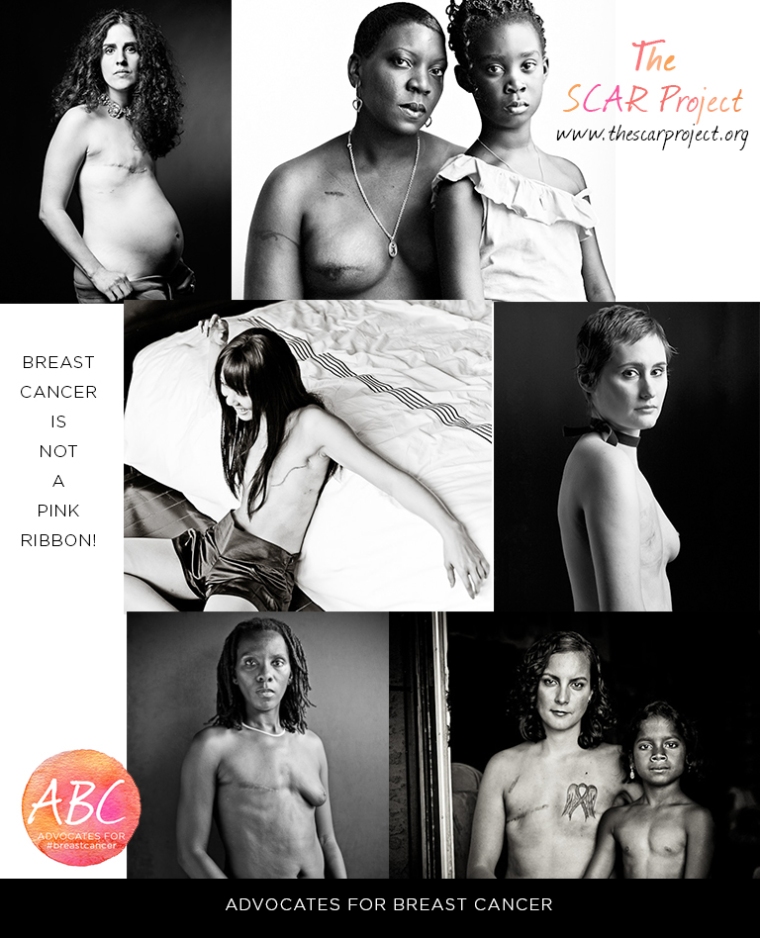 advocates-for-breast-cancer_south-africa_australian_the-scar-project